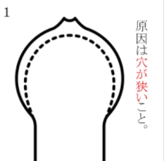【危険】キトー君の口コミ・評判は嘘?使い方を間違うと包皮が・・・